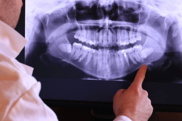 Best Emergency Tooth Extraction in Roosevelt Park, MI